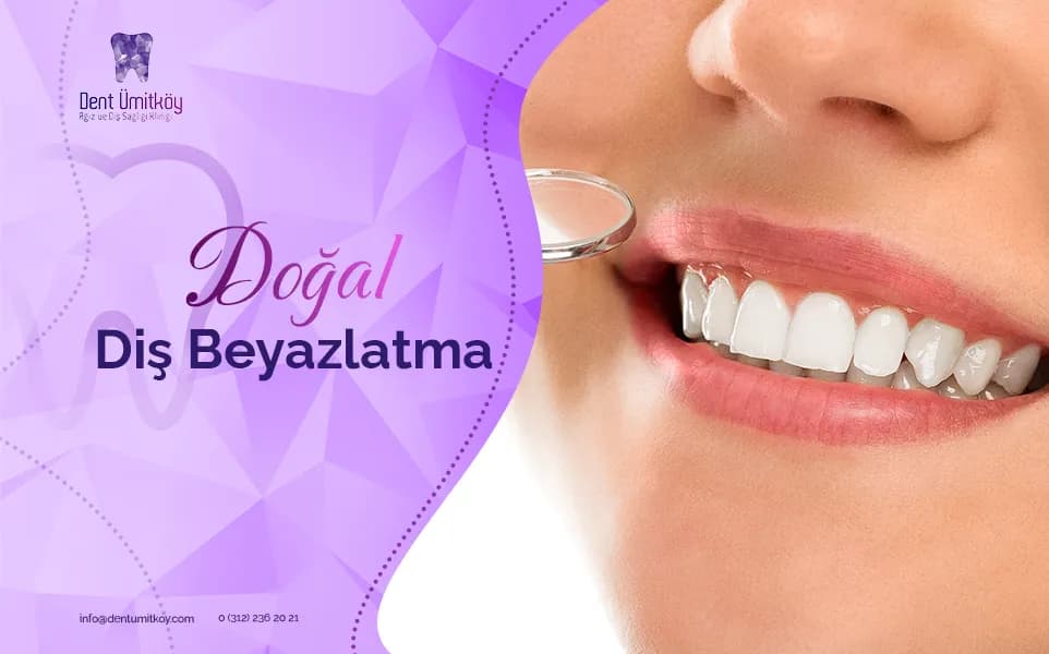 Natural Teeth Whitening