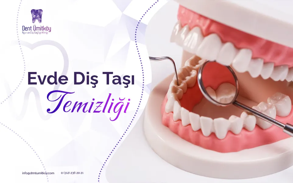 Evde Diş Taşı Temizliği