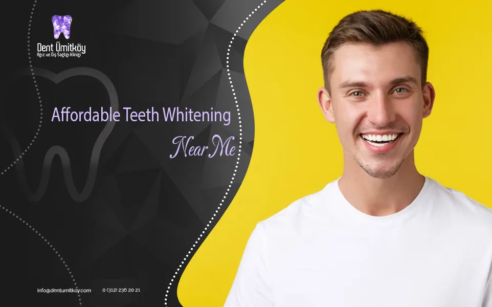 Affordable Teeth Whitening Near Me