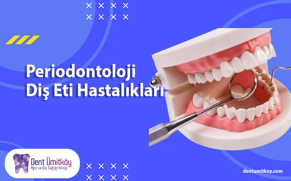 Periodontoloji Diş Eti Hastalıkları