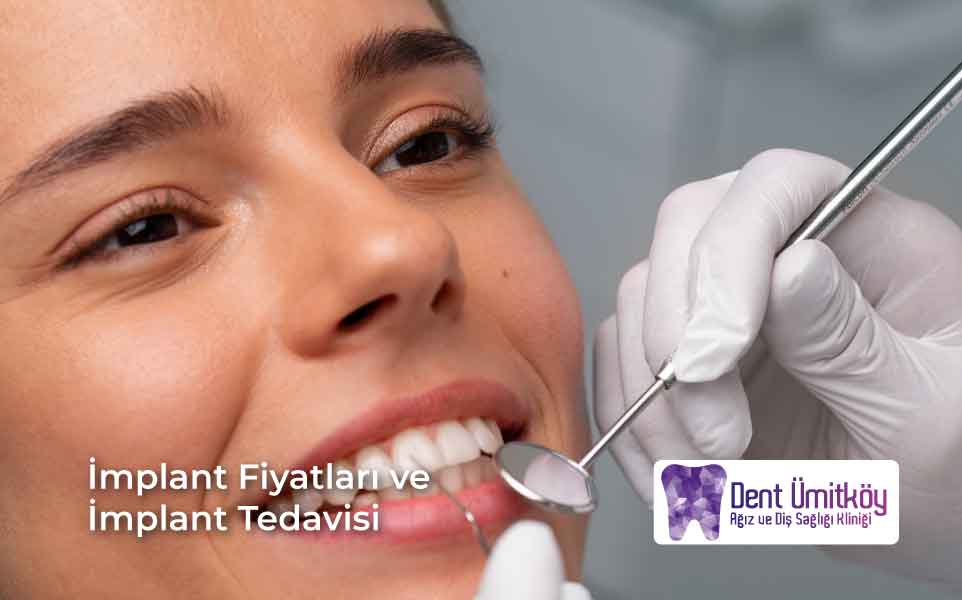 İmplant Fiyatları ve İmplant Tedavisi