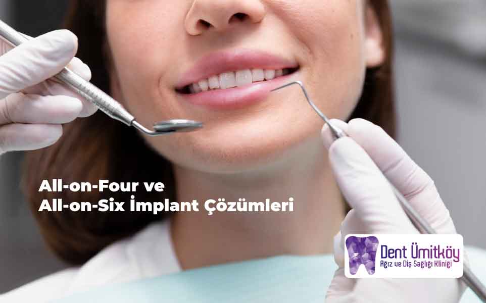 Tüm dişlerini kaybeden hastalar için implant çözümleri