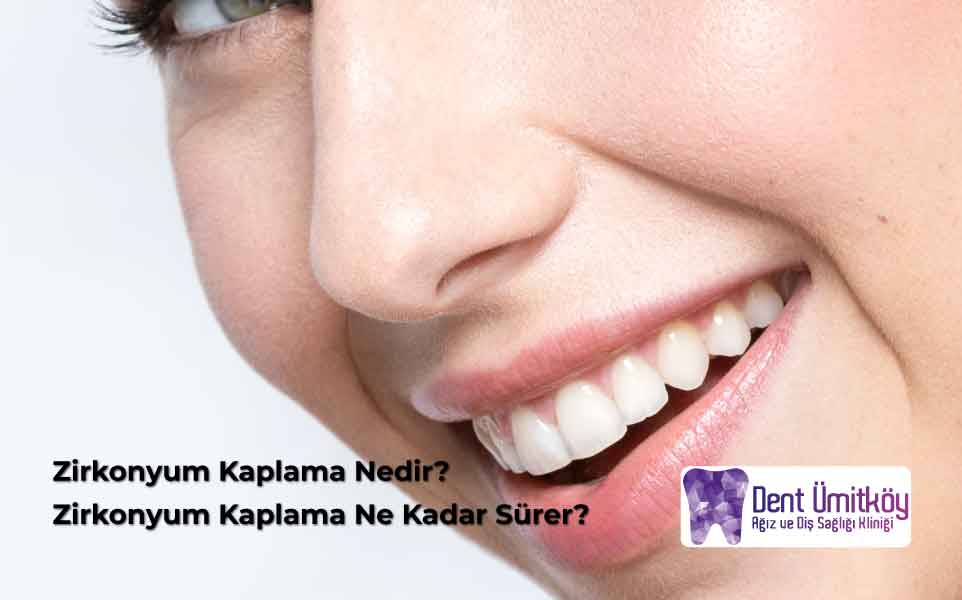 Zirkonyum Kaplama Ne Kadar Sürer