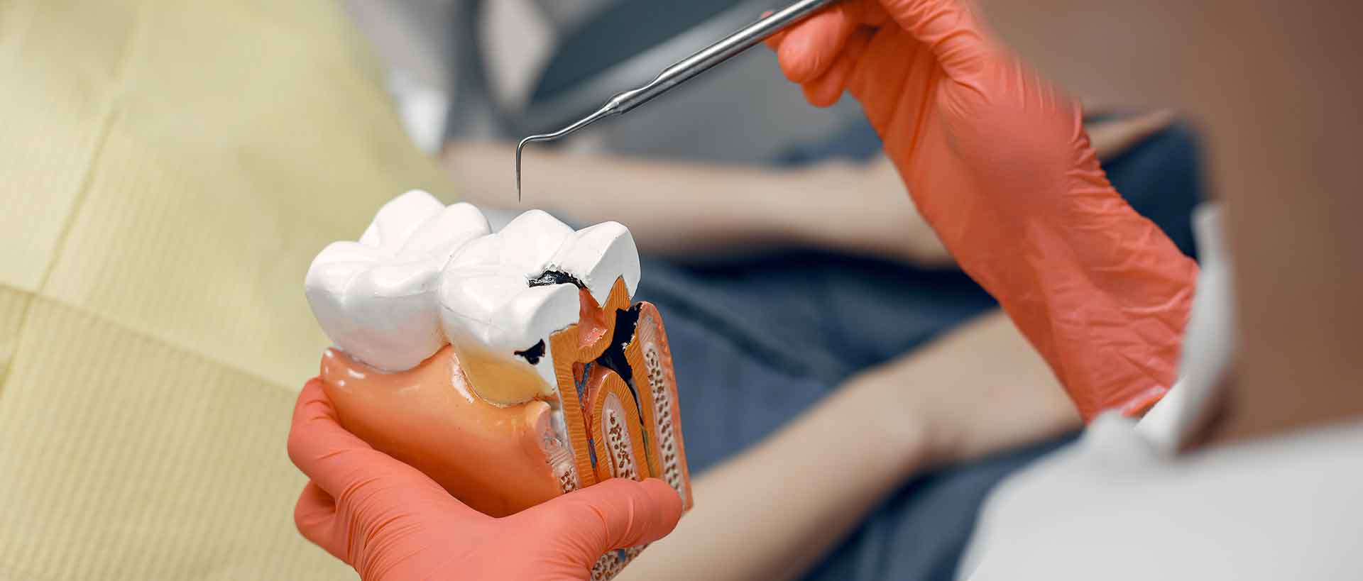 Kanal Tedavisi Endodonti Ankara