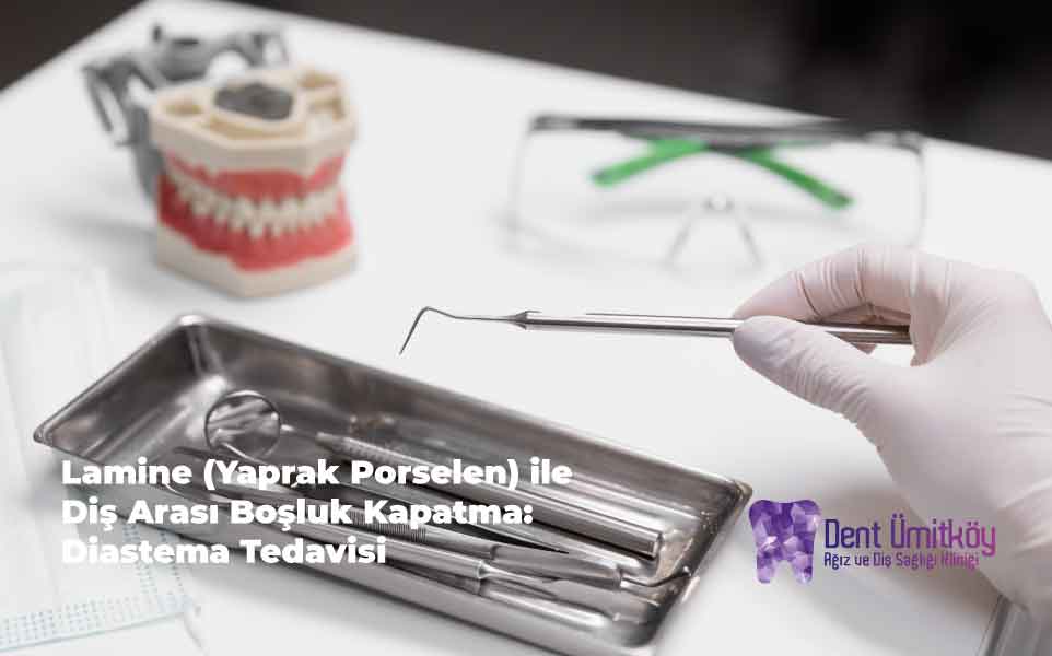 Lamine (Yaprak Porselen) ile Diş Arası Boşluk Kapatma