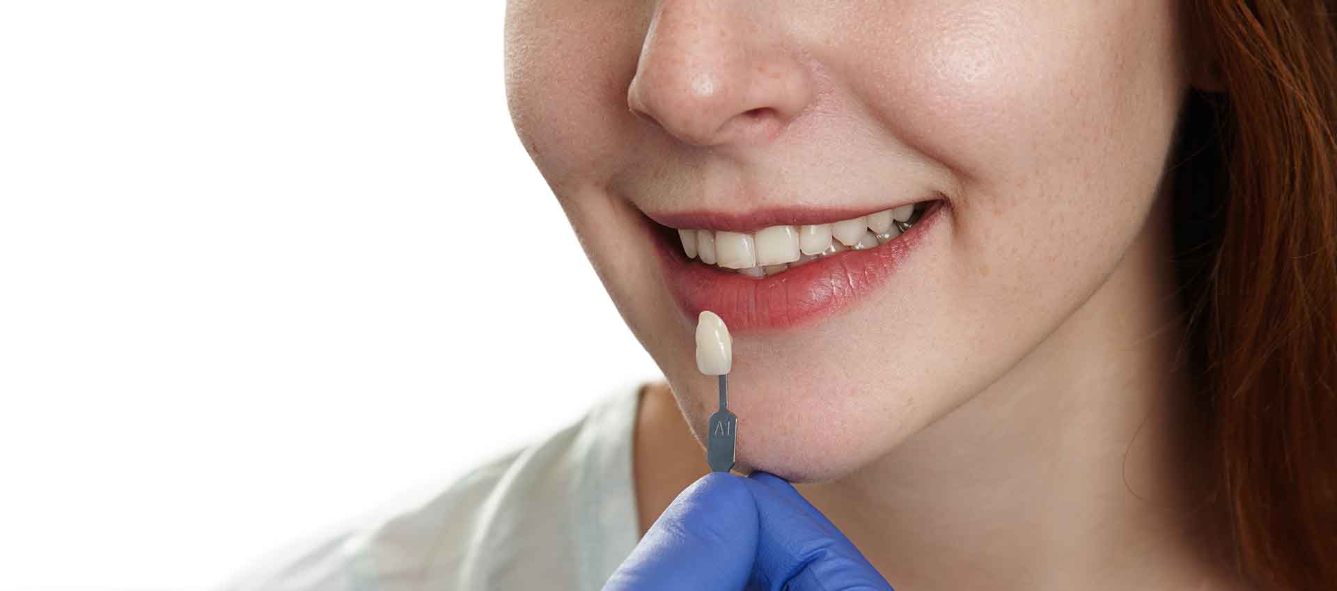 Zirkonyum Lamine Hangi Estetik Çözüm Size Uygun