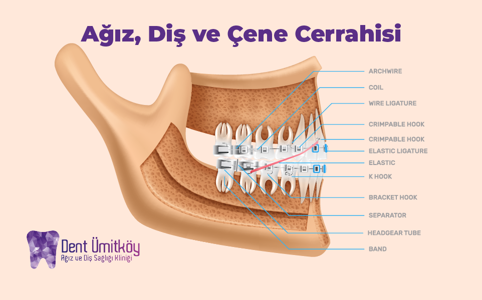 Ankara Ağız, Diş ve Çene Cerrahisi