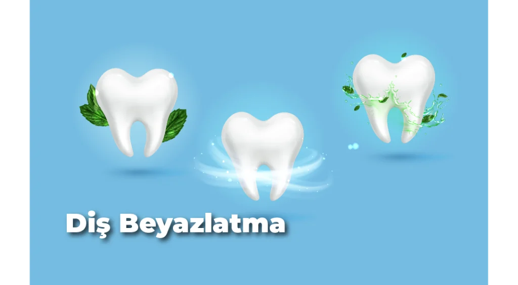Diş Beyazlatma Fiyatıları